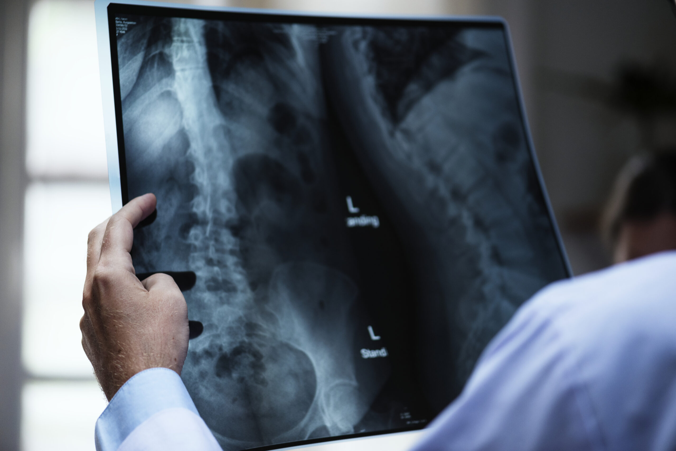 Dr. Francisco Arteaga Neurosurgeon|Spine neurosurgeon in Seville